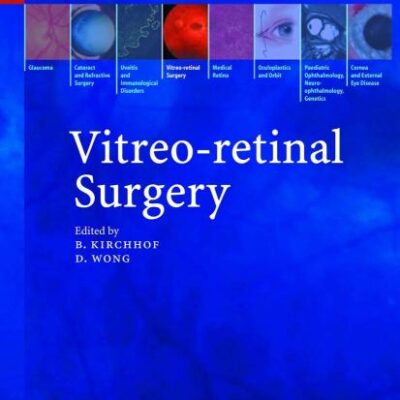 VITREO-RETINAL SURGERY