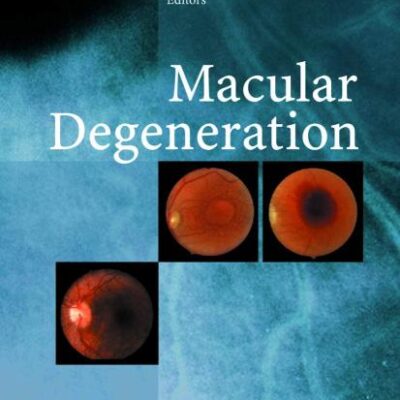 MACULAR DEGENERATION