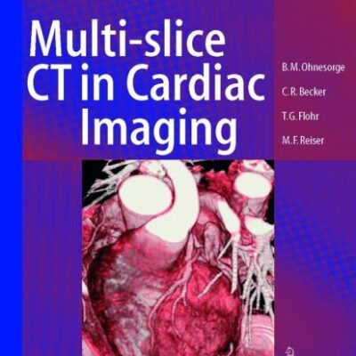 Multi-slice Ct in Cardiac Imaging (Pb): Technical Principles, Clincal Application and Future Developments