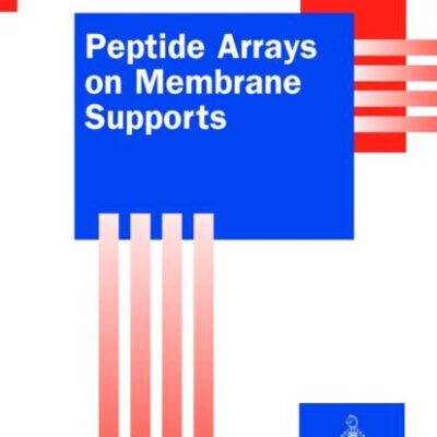 Peptide Arrays on Membrane Supports: Synthesis and Applications