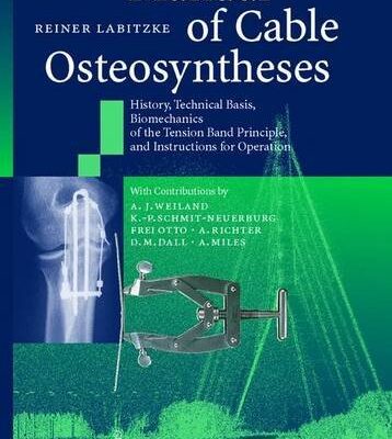 Manual Of Cable Osteosyntheses