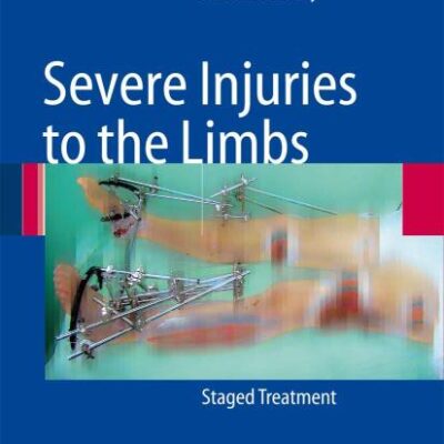 SEVERE INJURIES TO THE LIMBS: STAGED TREATMENT