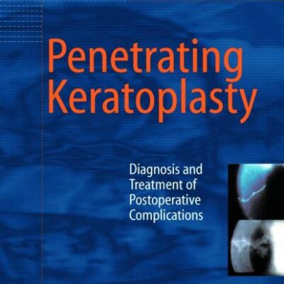 Penetrating Keratoplasty: Diagnosis and Treatment of Postoperative Complications