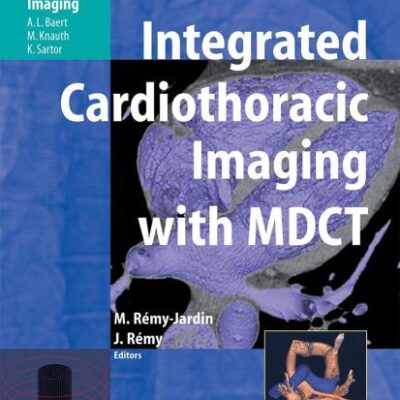 Integrated Cardiothoracic Imaging With Mdct (Hb)
