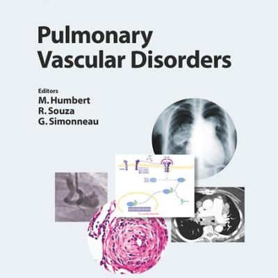 Pulmonary Vascular Disorders: 41 (Progress in Respiratory Research)