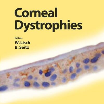 Corneal Dystrophies: 48 (Developments in Ophthalmology)