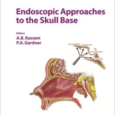 Endoscopic Approaches to the Skull Base (Progress in Neurological Surgery)