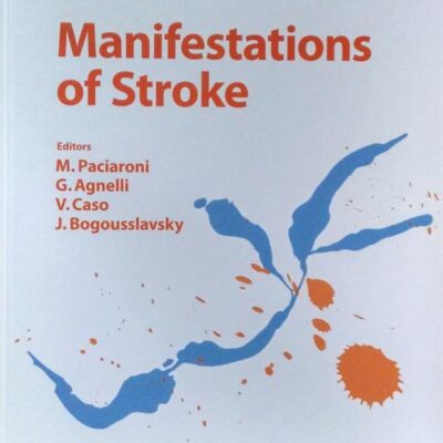Manifestations of Stroke (Frontiers of Neurology and Neuroscience)