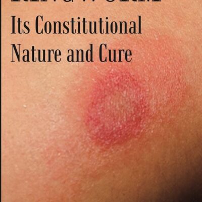 Ringworm: Its Constitutional Nature and Cure [Hardcover]