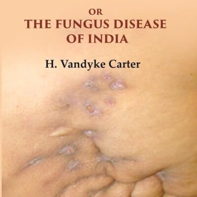 On Mycetoma or the Fungus Disease of India [Hardcover]