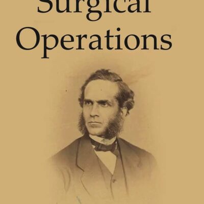 Hand-Book of Surgical operations