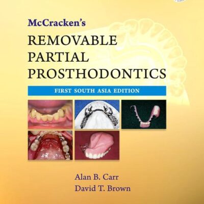 MCCRACKEN'S REMOVABLE PARTIAL PROSTHODONTICS