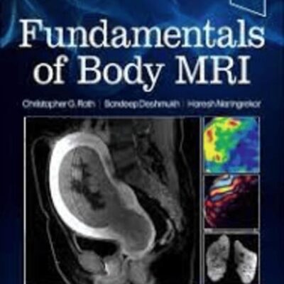 FUNDAMENTALS OF BODY MRI 3ED (PB 2025)