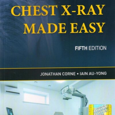 Chest X0Ray Made Easy, 5e