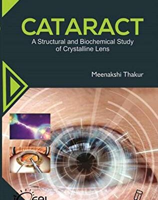 Cataract A Structural and Biochemic Study of Crystaline lens