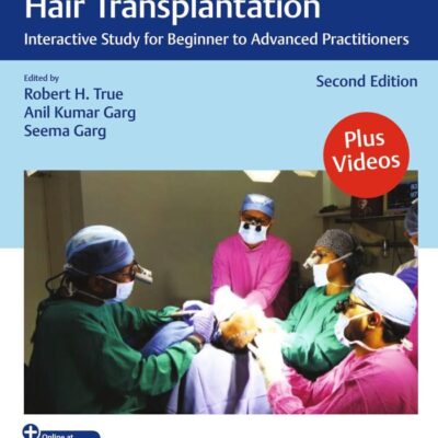 Practical Guide to Hair Transplantation: Interactive Study for Beginner to Advanced Practitioners