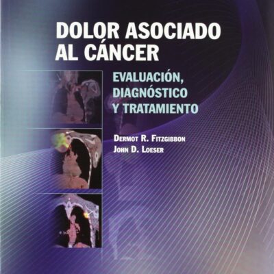 Dolor asociado al cancer