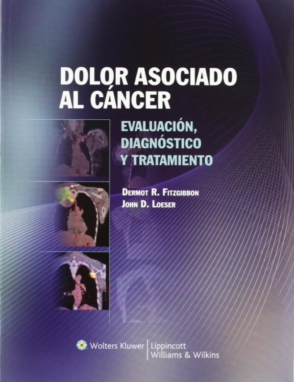 Dolor asociado al cancer