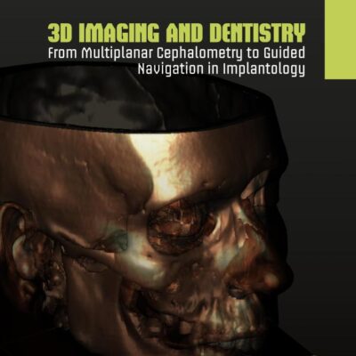 3D Imaging and Dentistry: From Multiplanar Cephalometry to Guided Navigation in Implantology