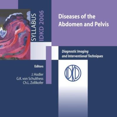 DISEASES OF THE ABDOMEN AND PELVIS