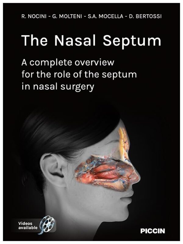 The Nasal Septum A complete overview for the role of the septum in nasal surgery