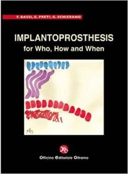 Implantoprosthesis For Who, How And When (Hb)