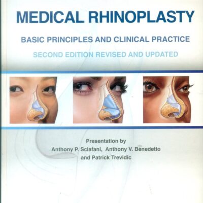 MEDICAL RHINOPLASTY BASIC PRINCIPLES AND CLINICAL PRACTICE 2ED (HB 2016)