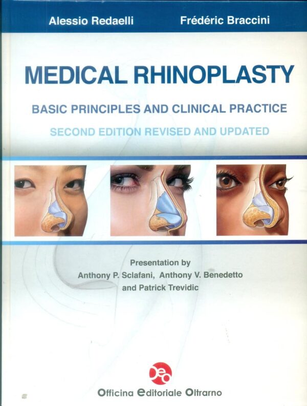 MEDICAL RHINOPLASTY BASIC PRINCIPLES AND CLINICAL PRACTICE 2ED (HB 2016)