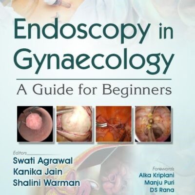 Endoscopy in Gynaecology | A Guide for Beginners ( PB 2025 )