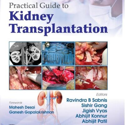 PRACTICAL GUIDE TO KIDNEY TRANSPLANTATION (HB 2025)