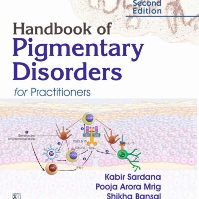 Handbook of Pigmentary Disorders for Practitioners