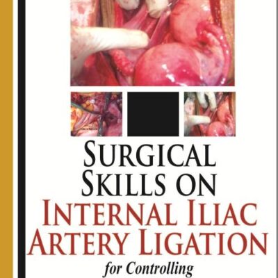 SURGICAL SKILLS ON INTERNAL ILIAC ARTERY LIGATION:FOR CONTROLLING POSTPARTUM & PELVIC HEMORRHAGE