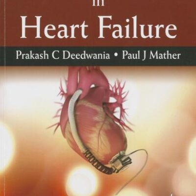 DRUG & DEVICE SELECTION IN HEART FAILURE