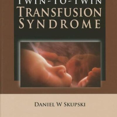 TWIN-TO-TWIN TRANSFUSION SYNDROME