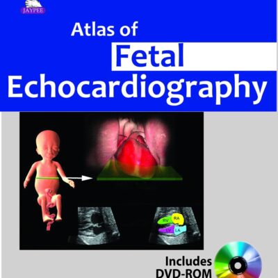 Atlas of Fetal Echocardiography with Interactive DVD-ROM