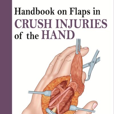 HANDBOOK ON FLAPS IN CRUSH INJURIES OF THE HAND