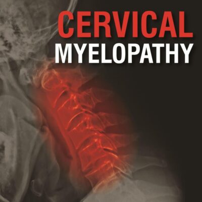 Cervical Myelopathy