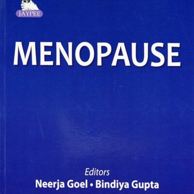 MENOPAUSE