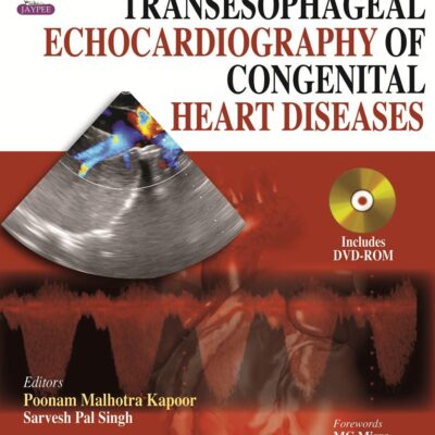 TRANSESOPHAGEAL ECHOCARDIOGRAPHY OF CONGENITAL HEART DISEASES