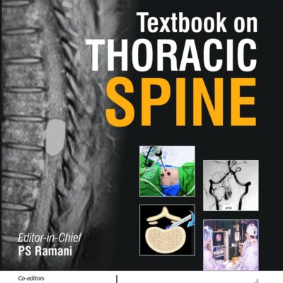 WFNS SPINE COMMITTEE TEXTBOOK ON THORACIC SPINE