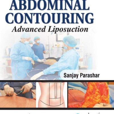 ART OF ABDOMINAL CONTOURING ADVANCED LIPOSUCTION WITH DVD-ROM