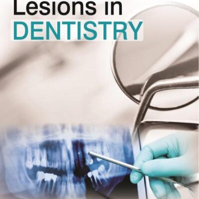 MUCOCUTANEOUS LESIONS IN DENTISTRY