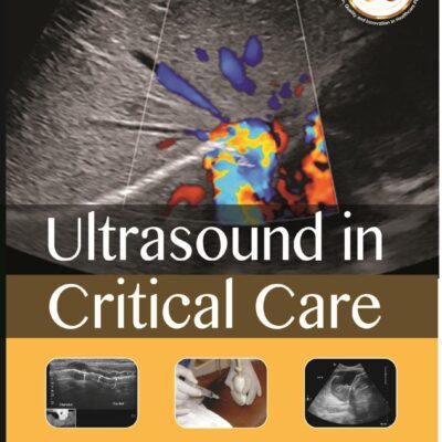 Ultrasound in Critical Care