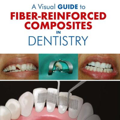 A Visual Guide to Fiber-Reinforced Composites in Dentistry