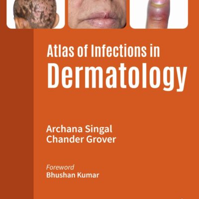 ATLAS OF INFECTIONS IN DERMATOLOGY