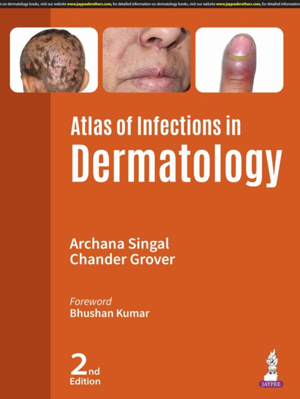 ATLAS OF INFECTIONS IN DERMATOLOGY