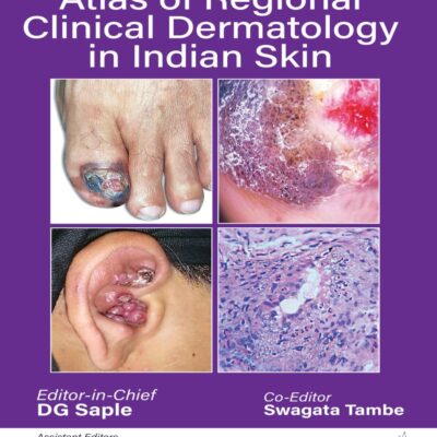 HANDBOOK AND ATLAS OF REGIONAL CLINICAL DERMATOLOGY IN INDIAN SKIN