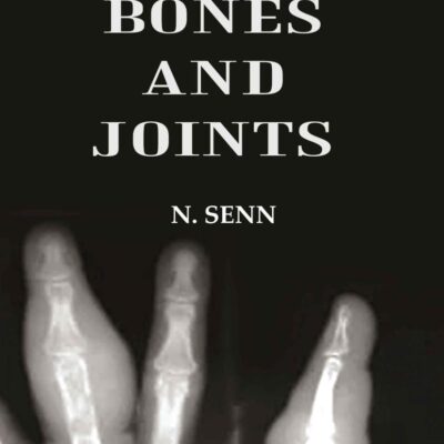 Tuberculosis of Bones and Joints [Hardcover]