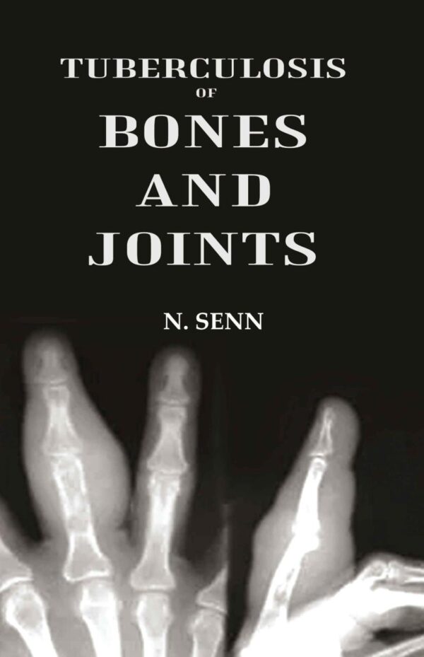 Tuberculosis of Bones and Joints hardcover medical textbook - 537 pages clinical reference published by Gyan Publishing House