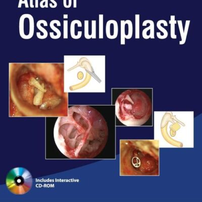 ATLAS OF OSSICULOPLASTY